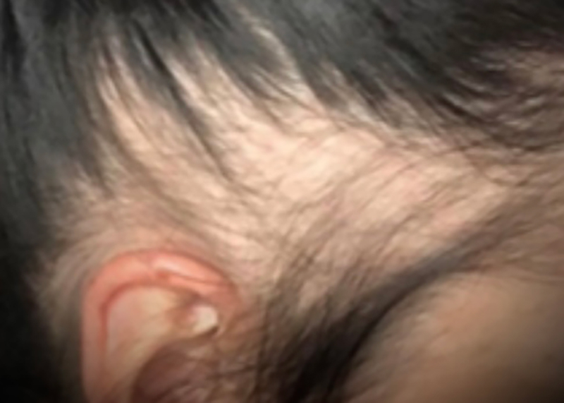 Before image